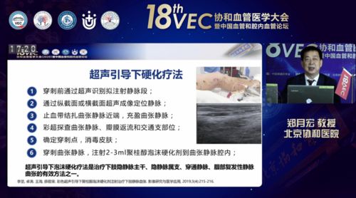 聚桂醇微創硬化治療技術學術推廣會六會同開，軟件助力數字化診療